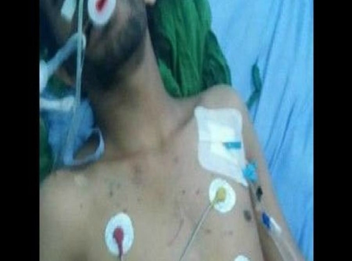Abductee dies after cruel torture in prisons of Houthis