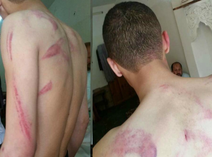 Principal in Sana’a brutally assaults schoolboy, while WJWC denounces incident