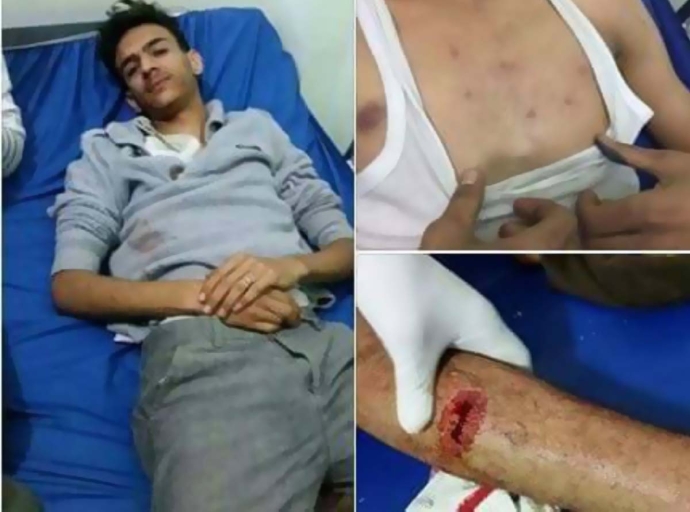 Houthi militia abducts and tortures a journalist’s son